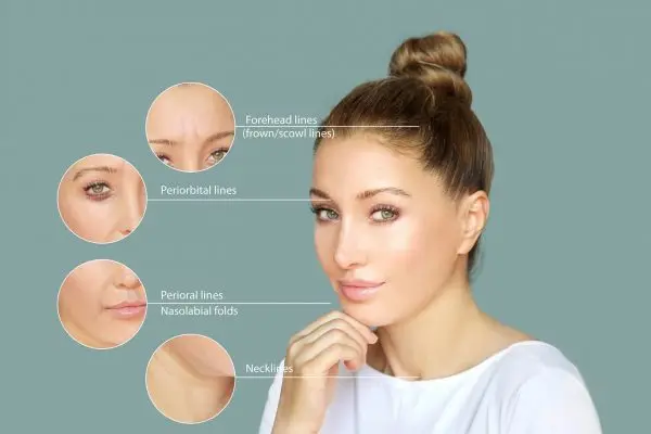 Effects of ageing,Frown/scowl lines ,Nasolabial folds,Neck ,Under eye circles,neck lines. Plastic Surgery Results